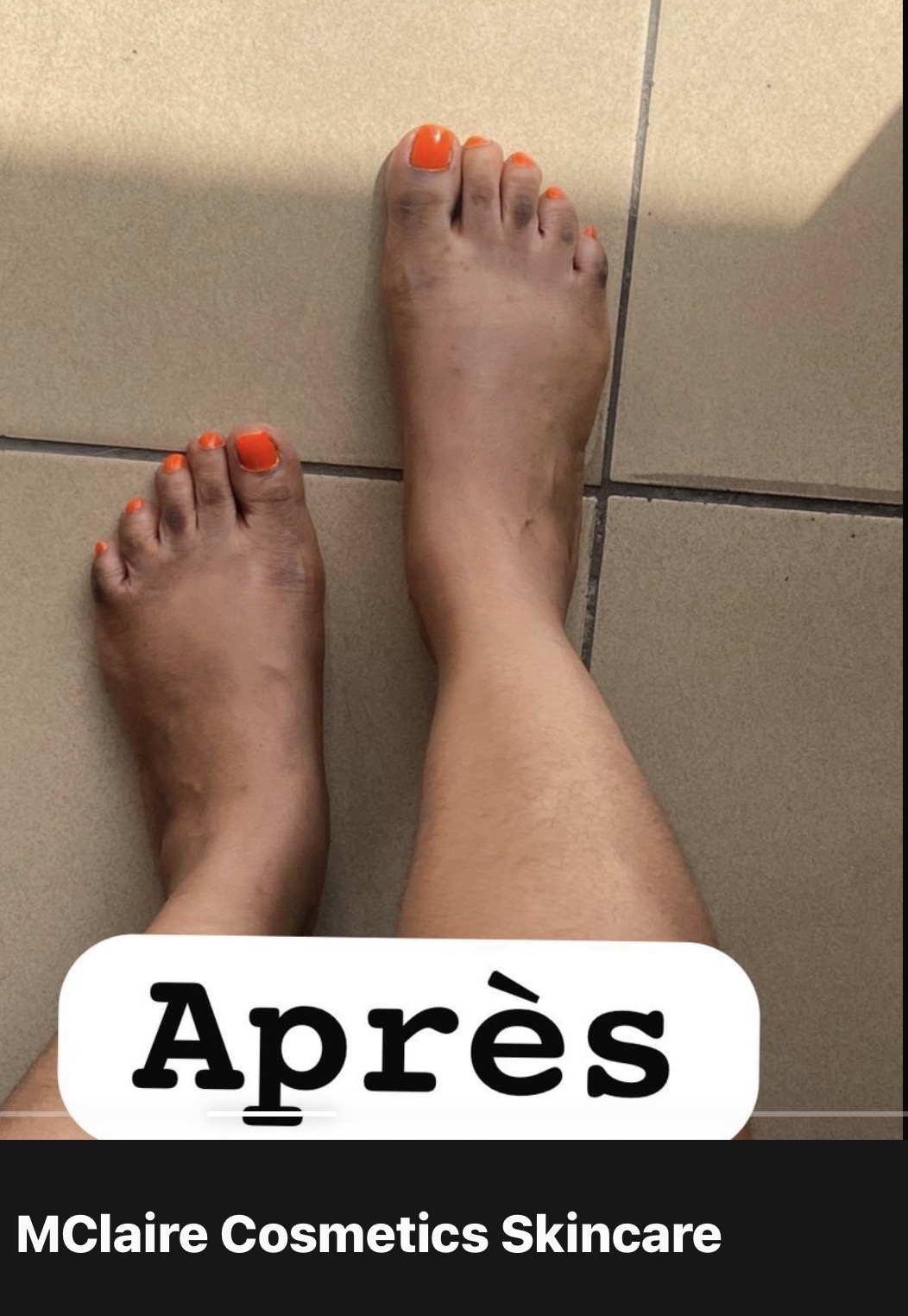 Après soin corps pieds résultat MCLaire
